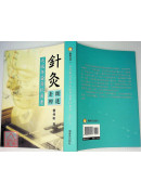 針灸衛道去邪之延年益壽抗衰老：中醫針灸抗衰老延年益壽方法