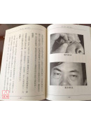 針灸秘驗(上下)、圖解針灸入門、針灸十絕招、眼針療法（國醫國寶系列套書共5冊）